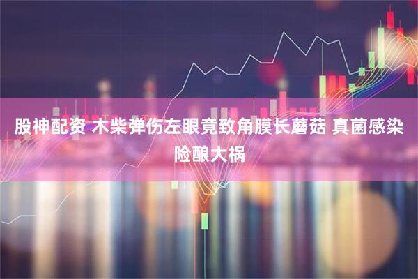 股神配资 木柴弹伤左眼竟致角膜长蘑菇 真菌感染险酿大祸